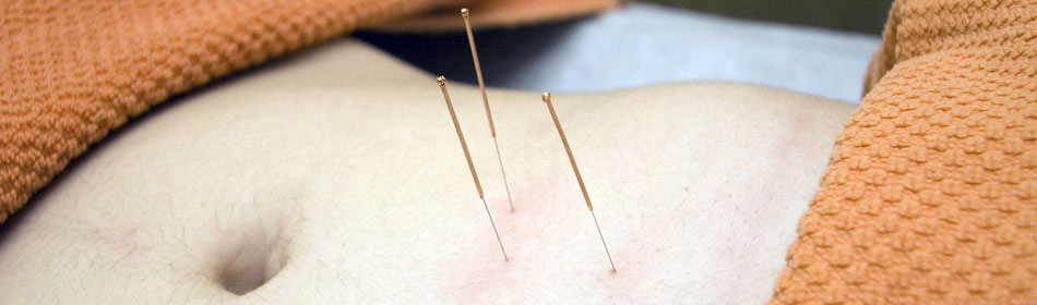Accupuncture, Eastern Healing Arts in the Souderton, Montgomery County PA area